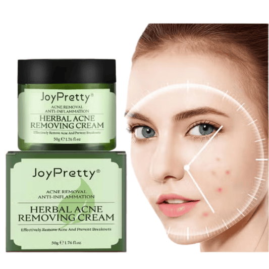 كريم ازالة حب الشباب - Ebuy.sa