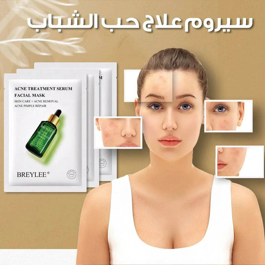 مصل معالجة حب الشباب بشجرة الشاي - Ebuy.sa