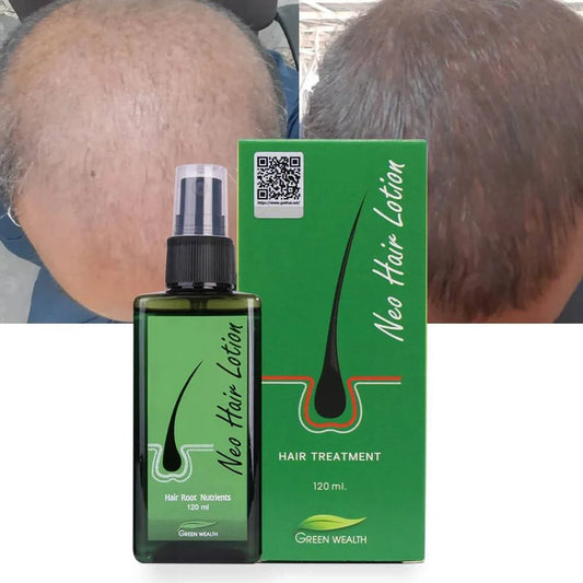 لوشن نيو هير - Ebuy.sa